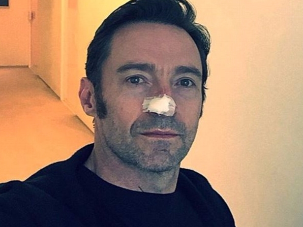 心疼金鋼狼！48 歲休傑克曼皮膚癌轉移再度復發　六度開刀向粉絲報平安！