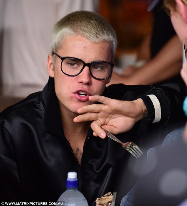 太操勞？小賈斯汀被近拍滿臉爆痘痘　女粉絲依然圍繞著偶像尖叫！