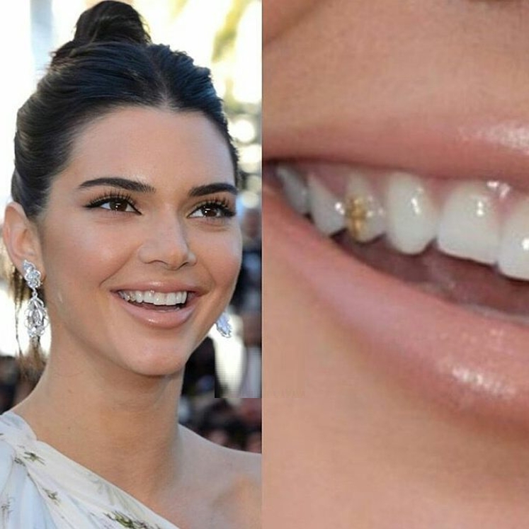 牙齒也要美？Kendall 十字架「牙飾」造型， 網友︰比上次金牙套好！