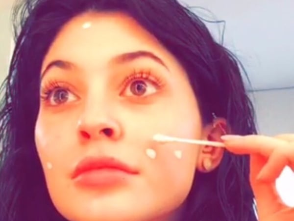 Bella Hadid 和 Kylie Jenner 也大愛!這支只售 17 美元的暗瘡水可以讓你的暗瘡一晚消失!