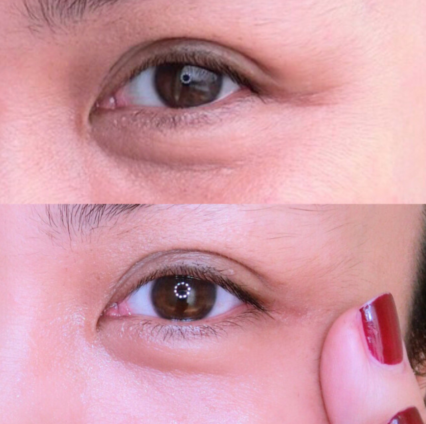 [嫑嫑的有感] 眼部呵護 九週除皺有感，我四周就有感了…狂笑中