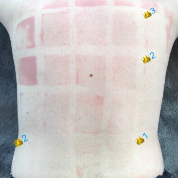 小紅書超狂博主實測「 15 款防曬品牌 3 小人肉高溫曝曬」！網友：左邊那塊是怎麼回事...