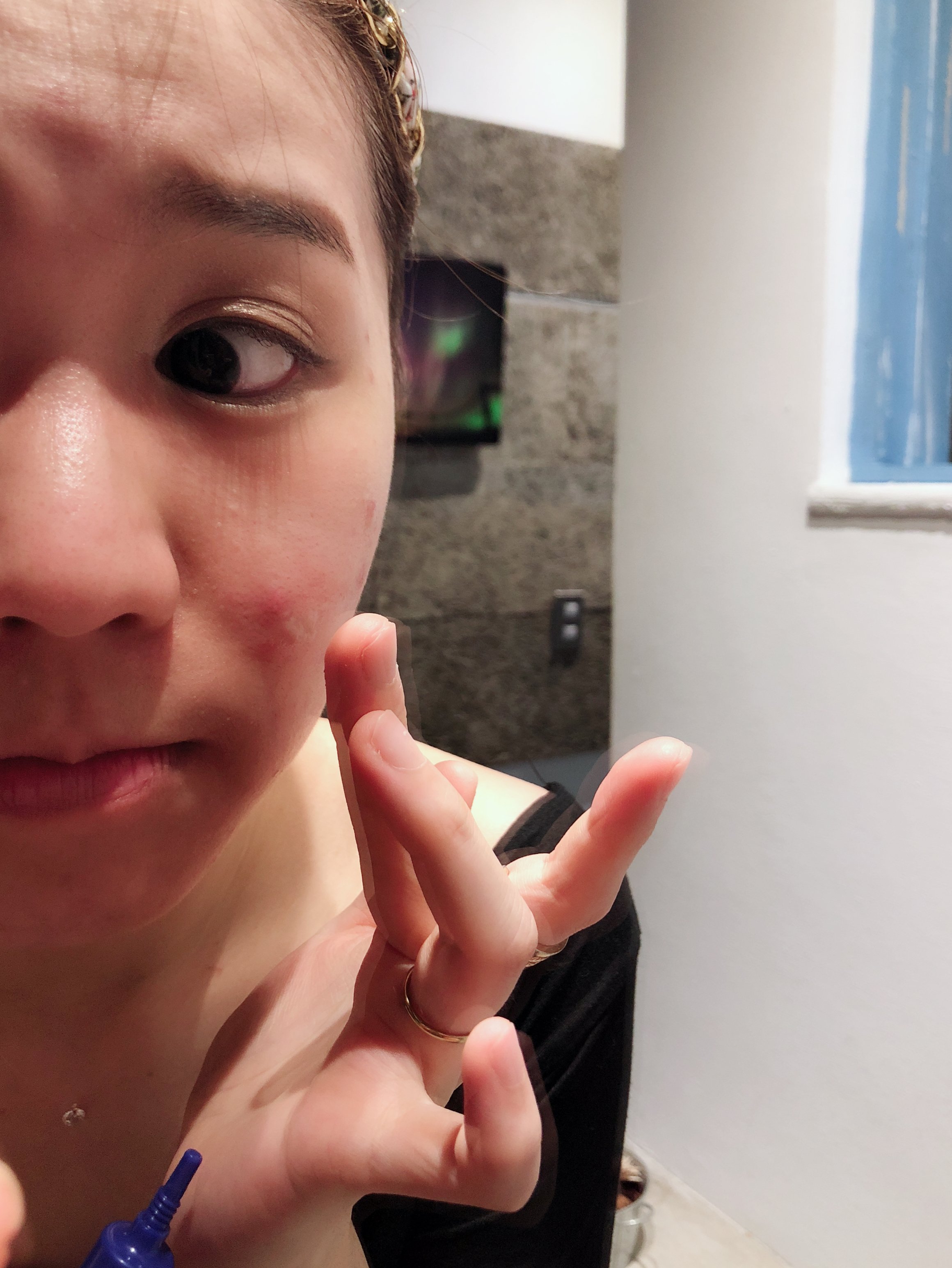 【嫑嫑der抗痘工程】左踢粉刺,右踢痘痘~我的抗痘神器