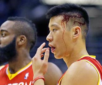 用生命在工作！南韓 NBA 球評「鼻血狂流」仍堅持播報比賽　一旁主播轉頭看到後直接嚇傻！