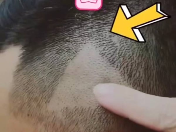 手機存照片給髮型師剪油頭？這位仁兄頭皮上出現謎樣箭頭笑翻