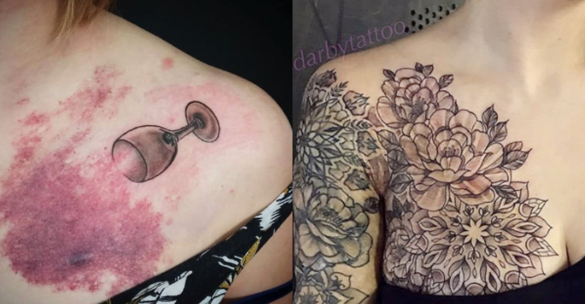 接受不完美的自己 50 張 絕望傷疤變成絕美刺青 刺上那一刻彷彿重生juksy 街星