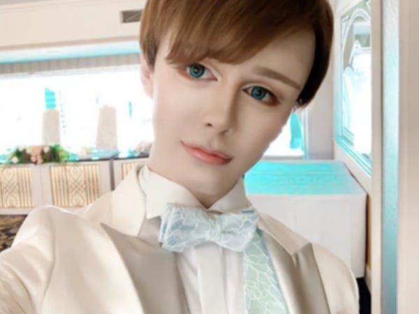 日本也有「蛇精男」！前職棒球星兒子宣稱：「沒整形」你相信嗎？