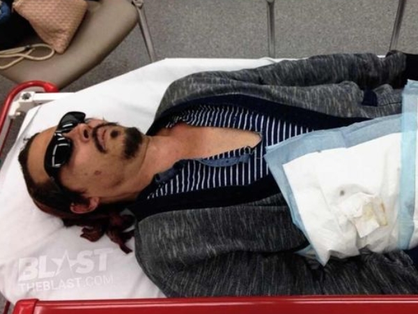 一代好萊塢巨星滄桑躺在病床上！強尼戴普再曝 Amber Heard 家暴證據「她拿菸燙我臉」！