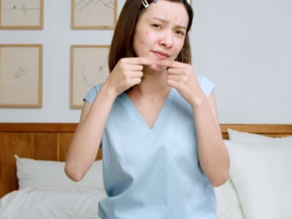 痘痘、粉刺這樣做反而會更嚴重？不用慌！潮模李柔的私房解法大公開，原來有它們就行了！