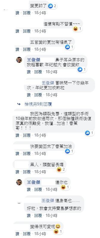 童顏模式說掰掰！「正顎香蕉」臉部消腫 65% 近照曝光　網再次受驚：比黑人帥一百倍！