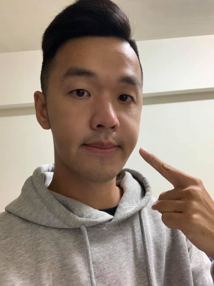 童顏模式說掰掰!「正顎香蕉」臉部消腫 65% 近照曝光 網再次受驚:比黑人帥一百倍!
